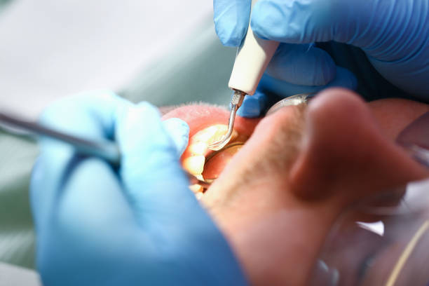 Best Pediatric Emergency Dentist in Cullowhee, NC