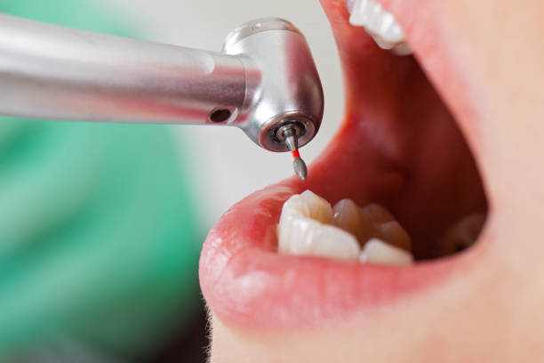 Best Same-Day Emergency Dental Services in Cullowhee, NC